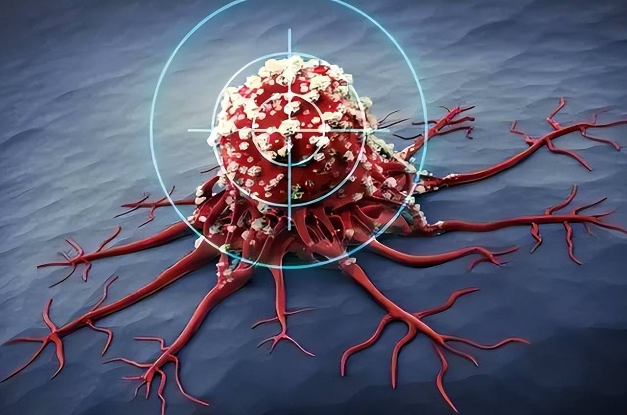 癌症病理基因大模型DeepGEM落地