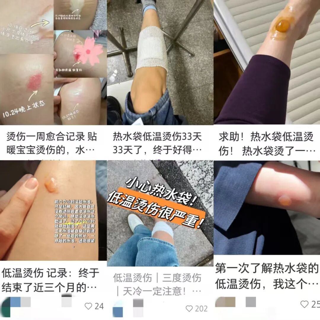 一觉睡醒，身上出现水疱？多半因同床共枕的Ta们