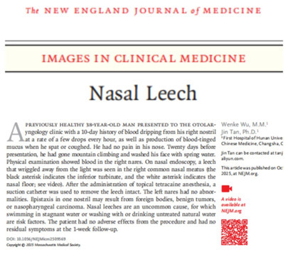 聚焦“鼻腔水蛭”感染，湖南这家医院学术成果登上国际学术舞台