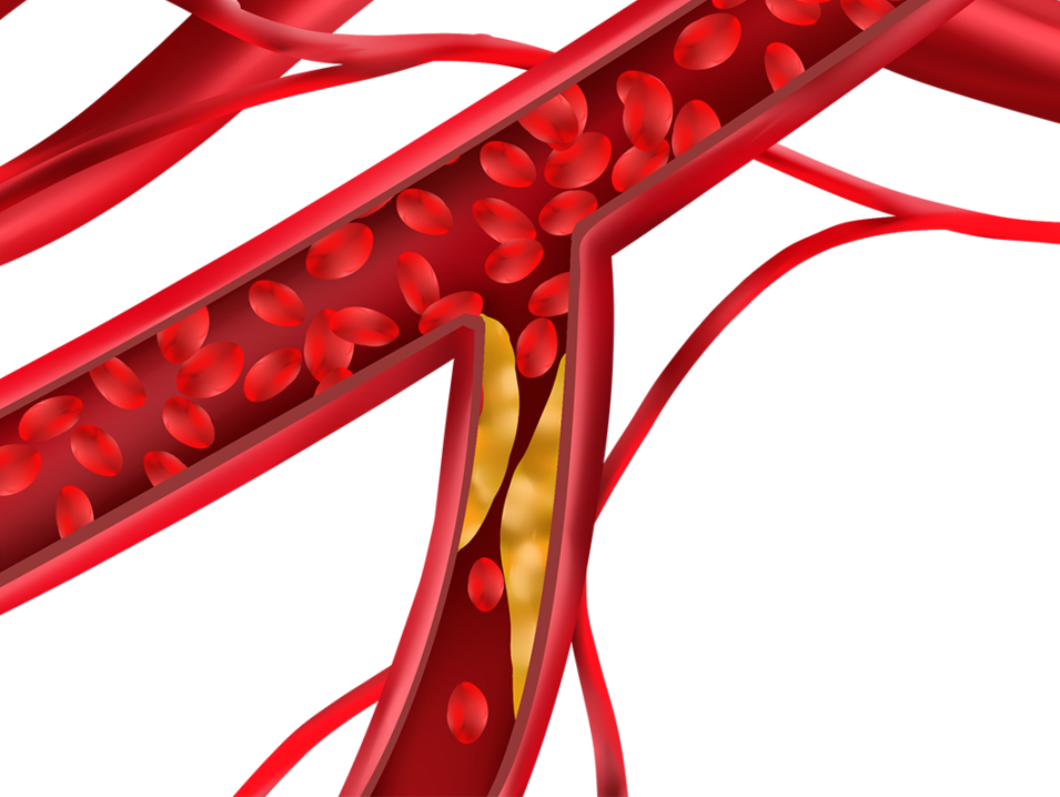 血管、淋巴系统医疗服务价格立项指南发布