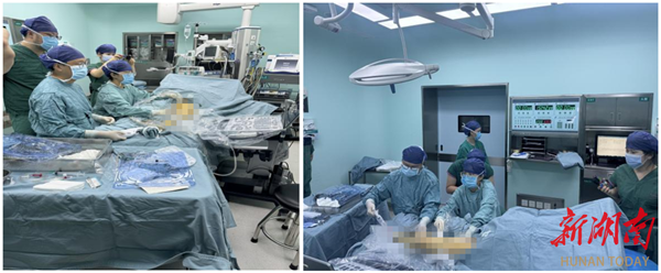 湖南首例！湘雅二医院成功实施MOCA技术，为静脉曲张患者带来“无痛”新选择