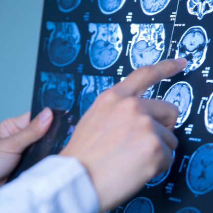 异地就医不用带片子啦！医学影像开启全国“漫游”