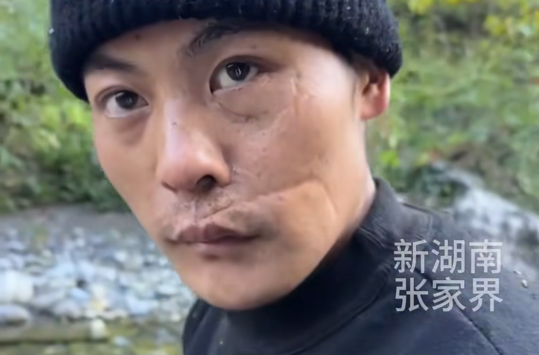 张家界荒野求生现“掏心”神操作 刀疤哥金句：人生无常大肠包小肠
