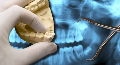 智齿反复发炎 竟致脸颊穿孔