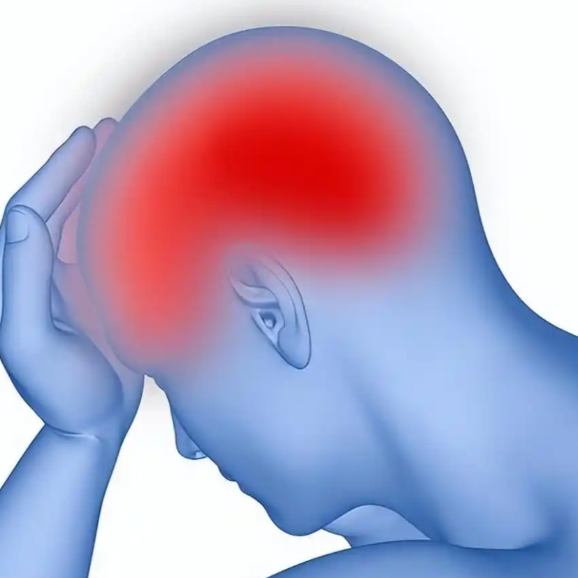 出现这些头痛症状，可能是颅内高压需警惕