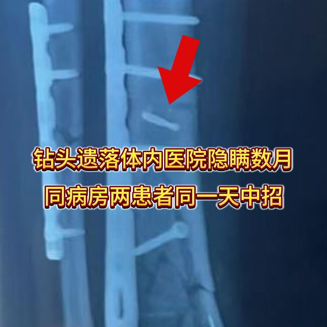 霞姐帮帮帮｜钻头遗落体内医院隐瞒数月，同病房两患者同一天中招