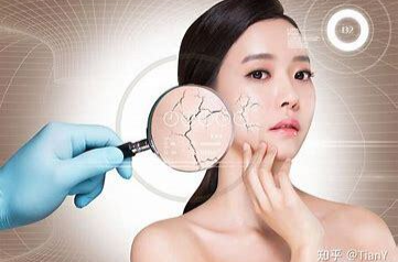 冬季祛斑黄金期，善待身体“哨兵”