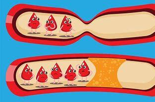 解析血脂管理十大常见误区与真相