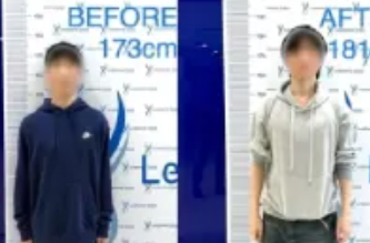 “断骨增高术”，在多平台死灰复燃