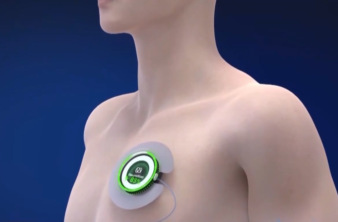 当脑机接口走入生活 会为我们带来哪些新可能？