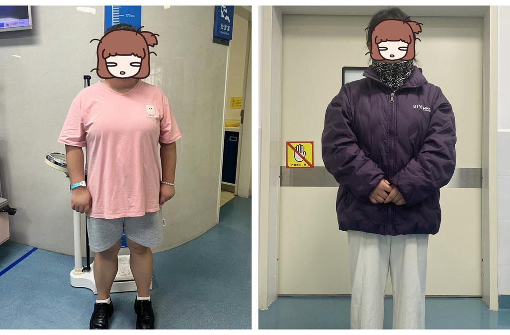 肠道置入“智能分流器” 湘西州人民医院微创破解肥胖代谢难题