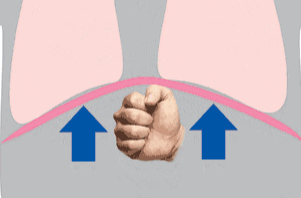 周末·知识丨“海姆立克急救法”更新了！（建议大家都学一下）