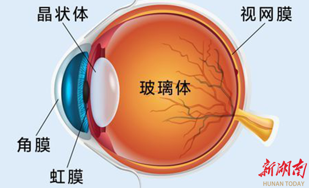 全市首例！常德一医开展白内障治疗新技术，可同步解决散光、近视、老花问题