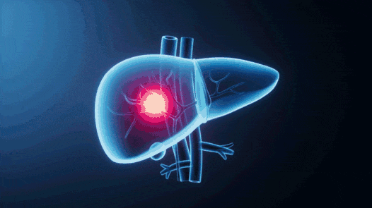 抓住养肝黄金期 建议做好这5件事