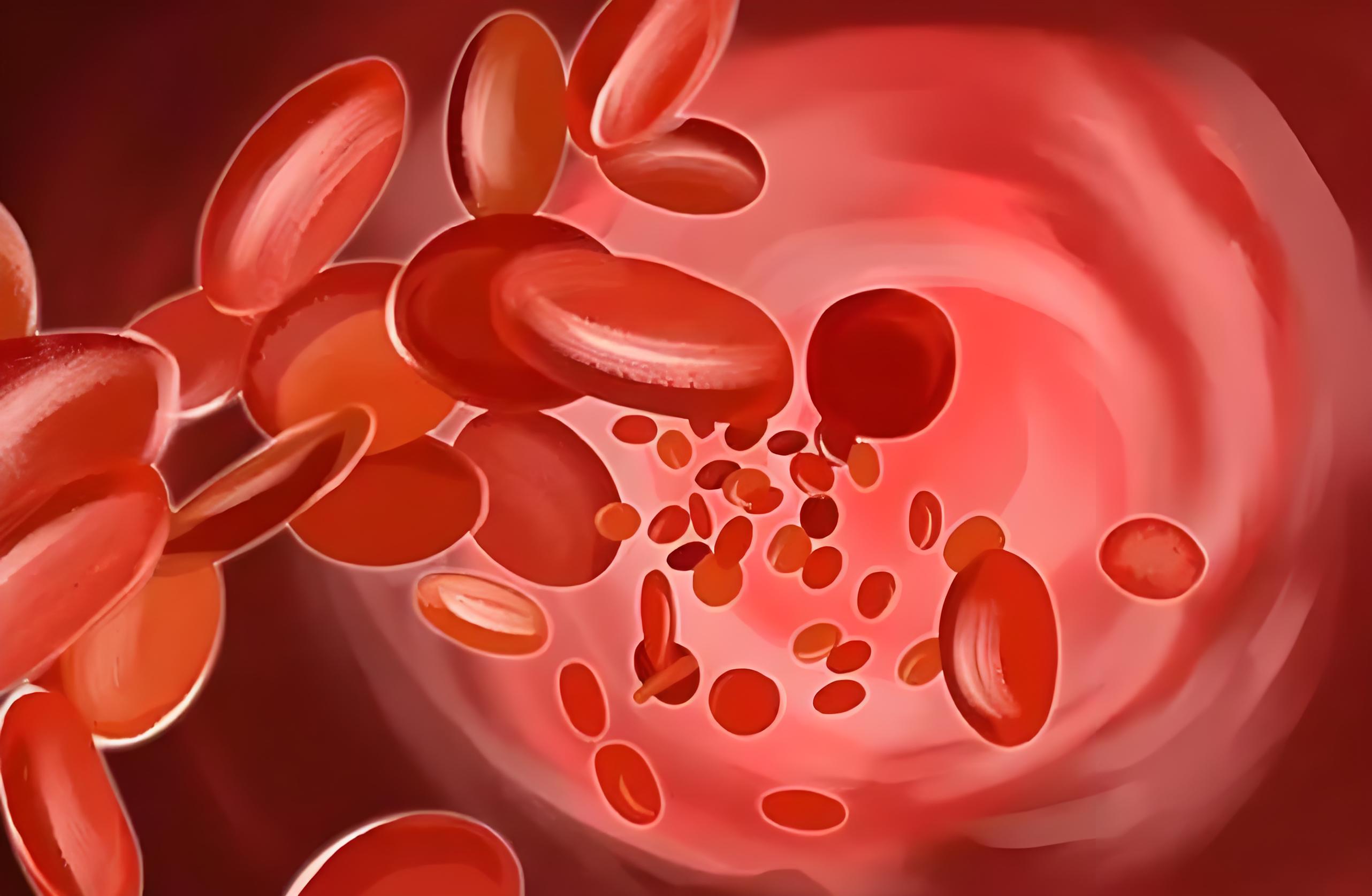 重型地中海贫血治疗难题被攻克