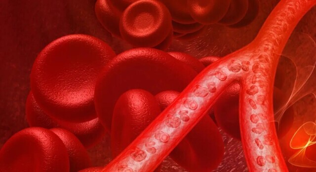 他不抽烟没“三高”，却突发心梗！医生：很多人忽视