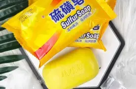 用硫磺皂洗澡洗出干性湿疹 医生提醒并非“万能神皂”