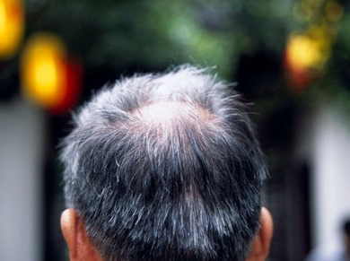 白头发别急着拔！试试这样做有望“由白转黑”