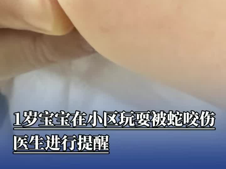 1岁宝宝在小区玩耍被蛇咬伤，医生进行提醒