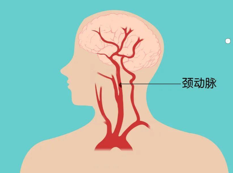 周末·健康丨一个伤害脑血管的动作，你每天都在做