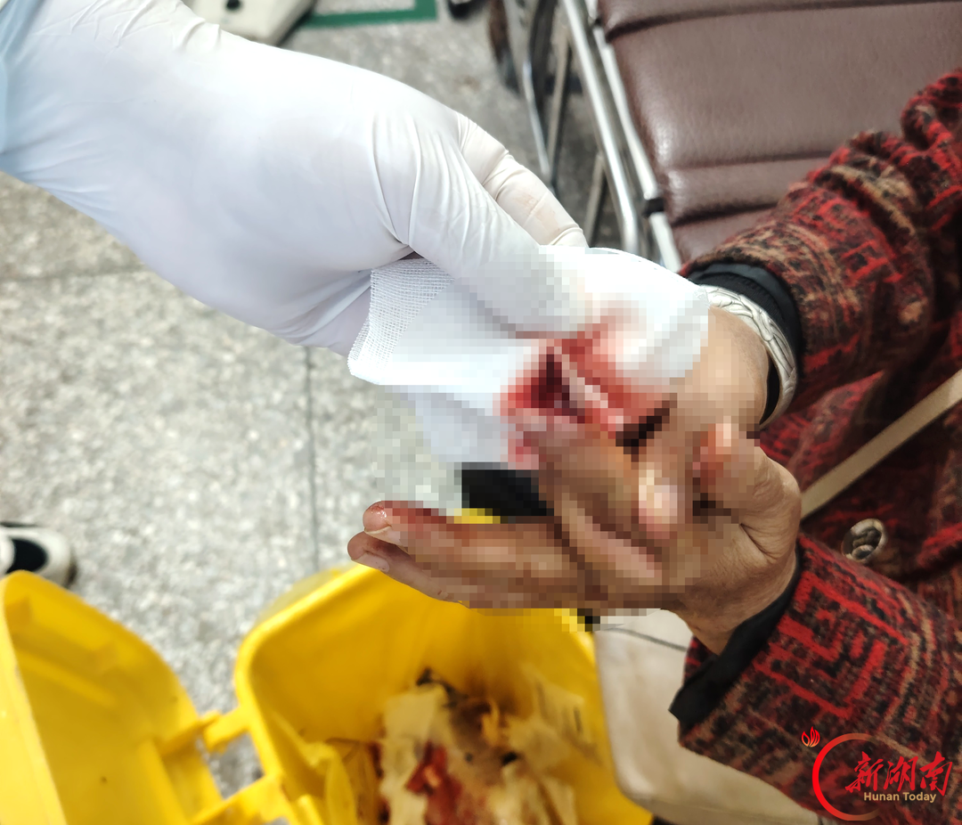 家门口的优质医疗！道县柑子园镇卫生院成功救治一名手指深度裂伤患者