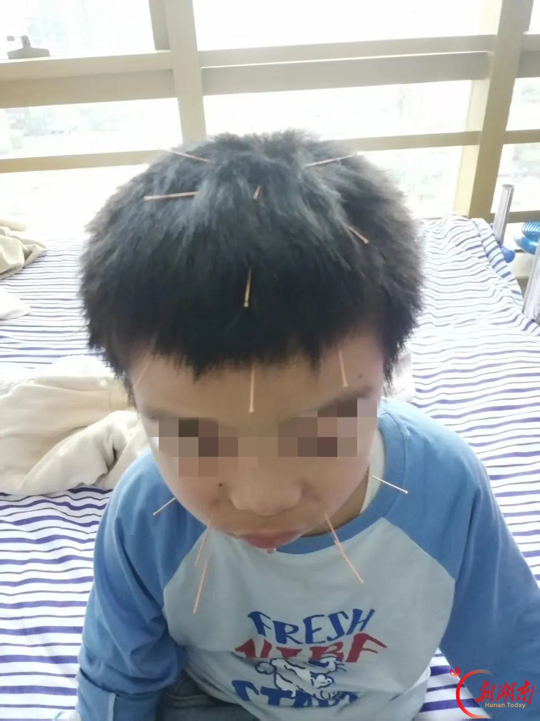 那个“长不大”的孩子，背起了小书包——一名脑瘫患儿的6年康复路