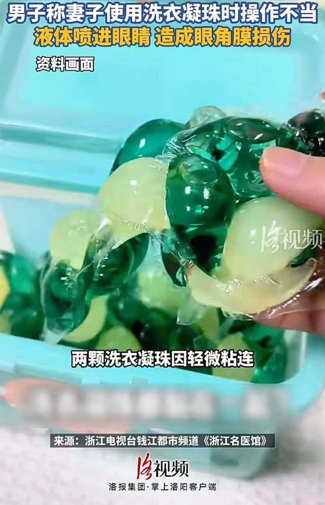 “爱用洗衣凝珠的人天塌了”冲上热搜，女子使用洗衣凝珠时，里面的高浓度洗涤液不慎溅入眼睛，眼角膜被腐蚀；医生提醒