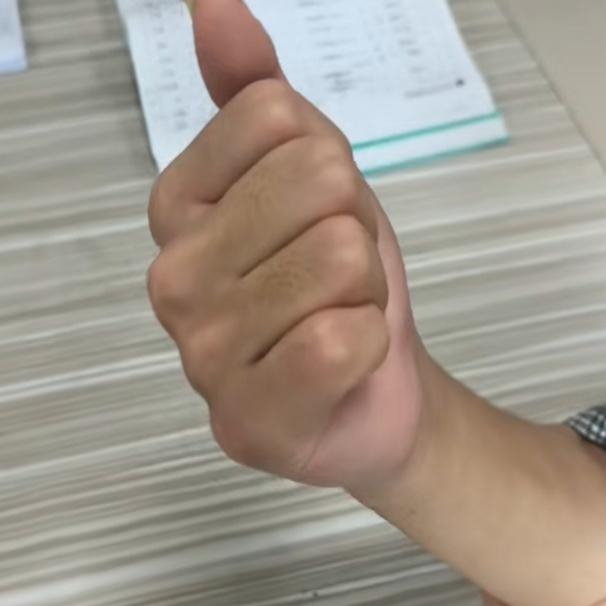 排除“腕”难之别让手腕“松垮”毁生活