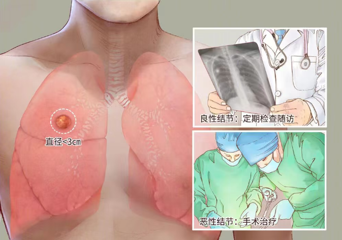 体检查出它别不在意 小心拖成癌!