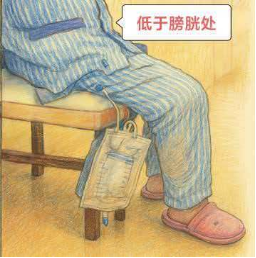 康复之路⑦|留置导尿管回家,该怎么护理?别慌,做好这几步就安心!