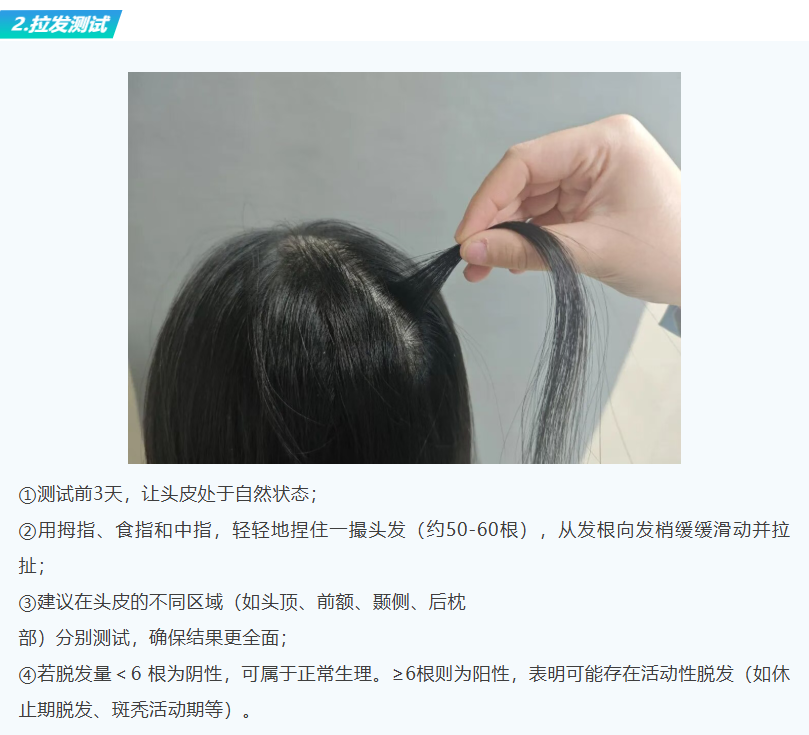 科普 | 成年人的崩溃，挺“秃”然的...