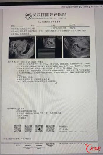 十二年求子家庭迎来新生希望 江湾医院多学科协同攻坚不孕难