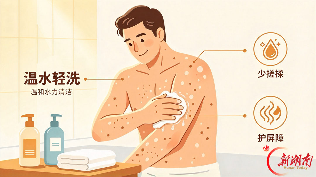 秋冬银屑病总“反扑”?这三招帮您稳住!