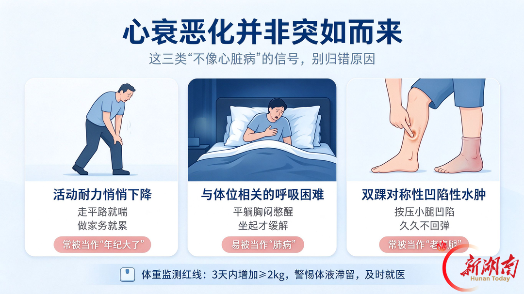 心衰恶化并非“突如其来” 注意三类信号