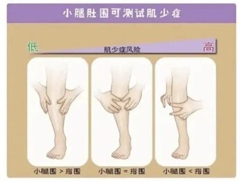 千金难买老来“肉”,小心老年性肌少症