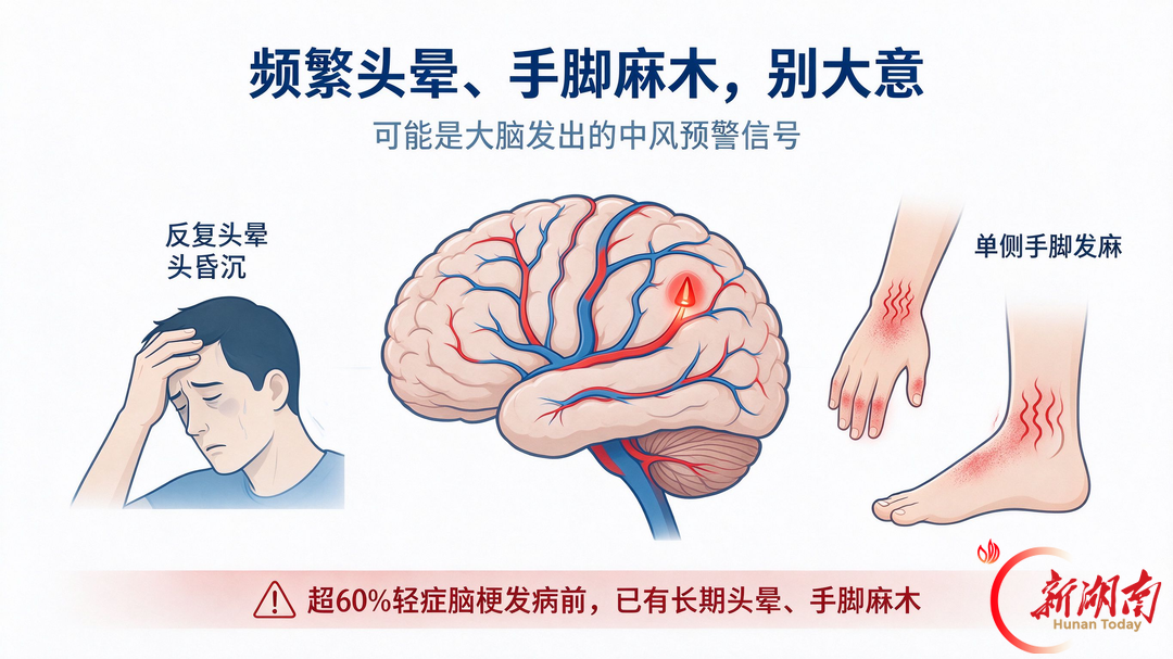 世界卒中日:频繁头晕、手脚麻木别大意!很多人看错病因,神经内科医生讲清真相