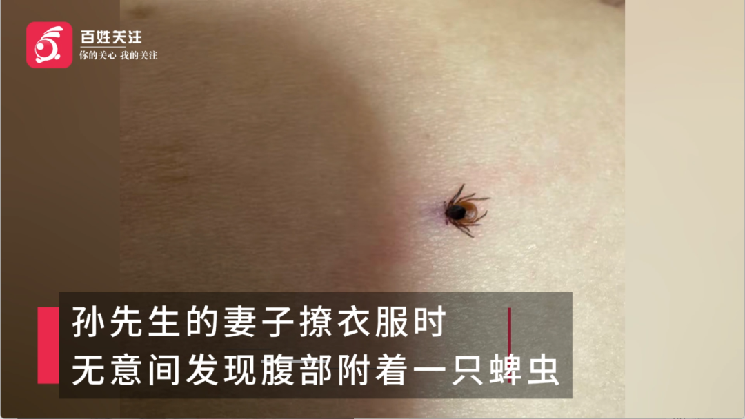 女子户外游玩时被蜱虫叮咬，半个月后住进ICU 疾控部门提醒：户外出行时要做好个人防护