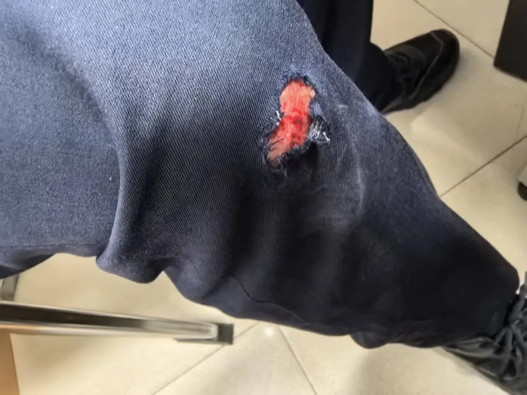 民警连追4条街，嫌疑人：“你也太拼命了！”