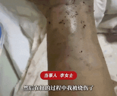 没用也没碰，衣柜里突然爆炸起火！这个物品很多人都有→