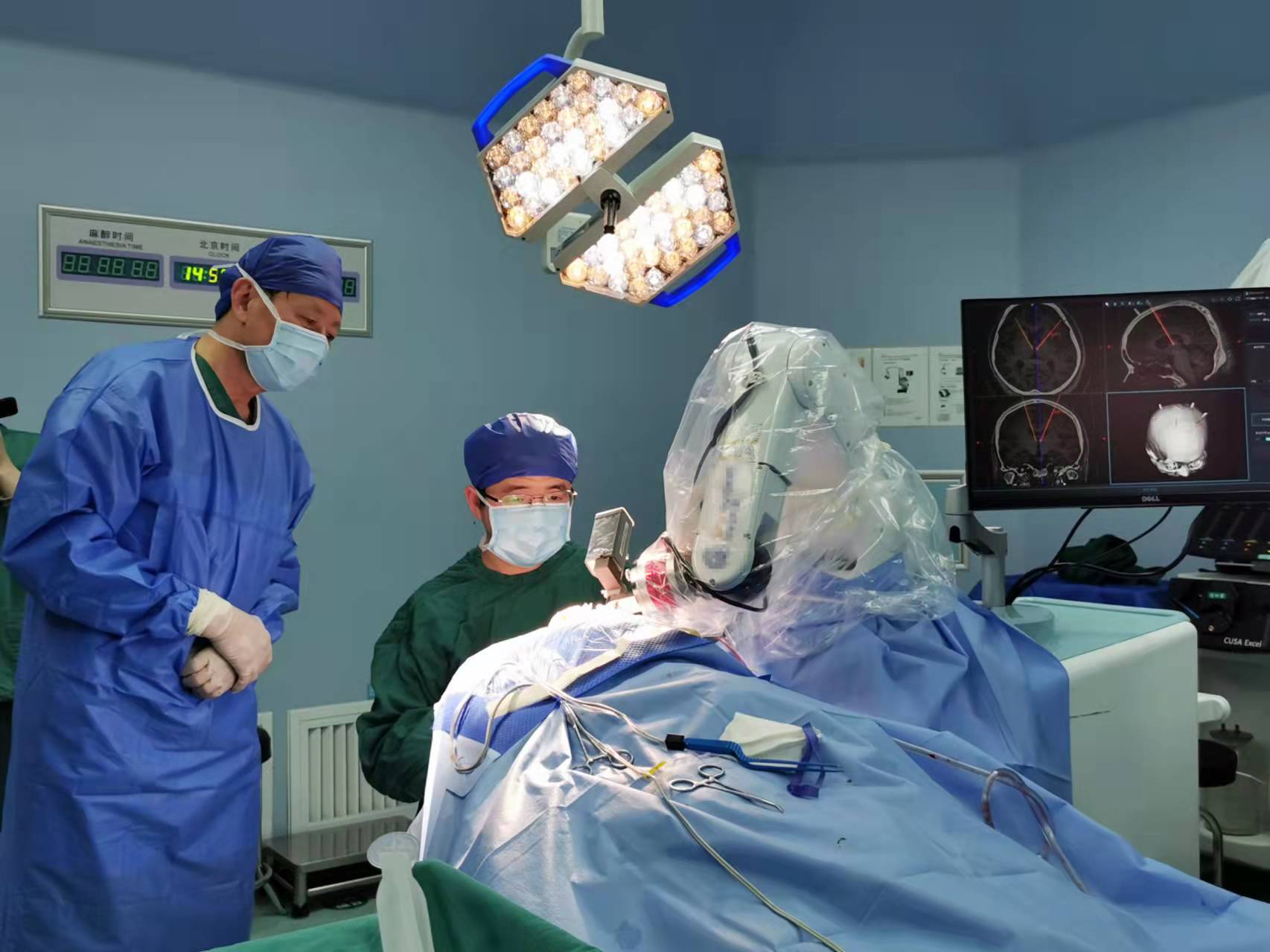 湖南成功实施首例"机器人植入脑起搏器治疗难治性癫痫"手术