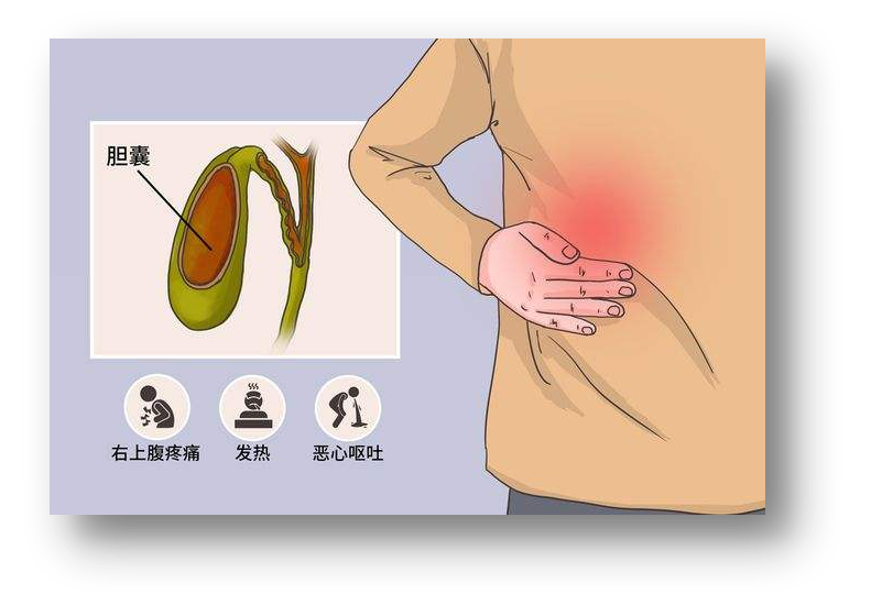 胆囊痛的位置示意图图片