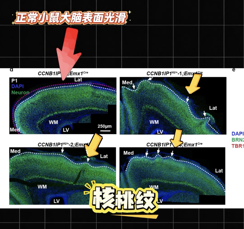 小鼠长出人脑褶皱!中国科学家找到人类超高智力关键基因
